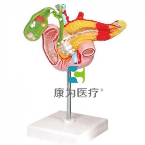“康為醫(yī)療”病理模型胰腺模型，十二指腸和膽囊模型