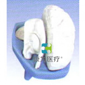 “康為醫(yī)療”內(nèi)囊位置、組成及分布模型