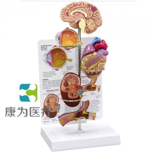 “康為醫(yī)療”醫(yī)患關系溝通模型-微型腦、眼、心、腎及動脈模型 （醫(yī)學指導模型）