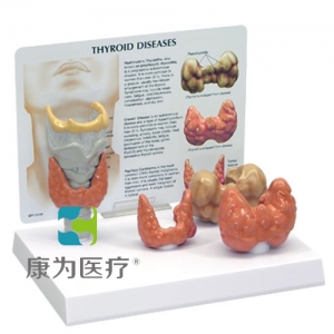 “康為醫(yī)療”細胞亞顯微結構模型“康為醫(yī)療”醫(yī)患關系溝通模型-甲狀腺帶軟骨、氣管模型（醫(yī)學指導模型）