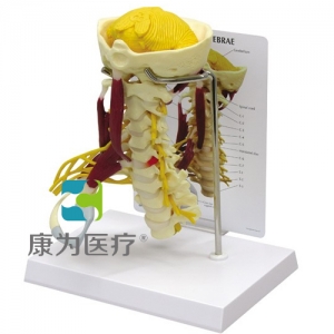 “康為醫(yī)療”醫(yī)患關系溝通模型-頸椎帶神經(jīng)、肌肉附小腦模型 （醫(yī)學指導模型）