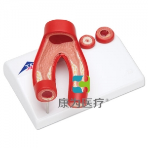 動(dòng)脈硬化模型，帶動(dòng)脈切面，2部分