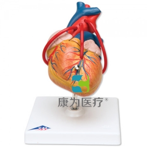 經(jīng)典心臟搭橋模型，2部分